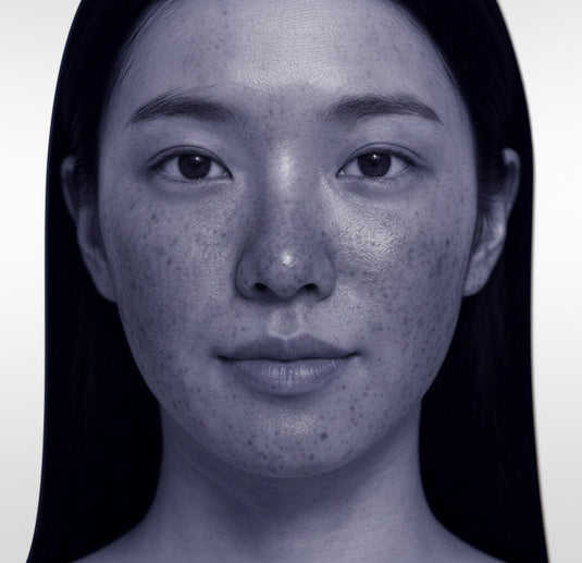 Skin ageing signs including dull tone spots and uneven texture. Skin ageing signs including dull tone spots and uneven texture