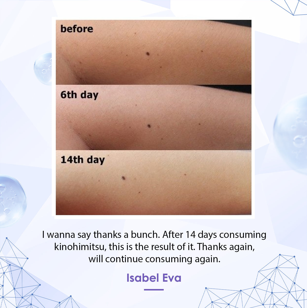 ProWhite – Kinohimitsu Malaysia testimonial image showing skin improvement over 14 days, with text expressing satisfaction with the product's results.