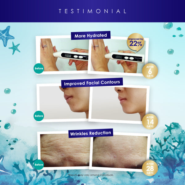 Testimonial graphic for Kinohimitsu Malaysia's Marine Gem product showing before and after results. Images depict increased hydration by 22% after 6 days, improved facial contours after 14 days, and wrinkles reduction after 28 days. Background features marine elements like starfish and bubbles.