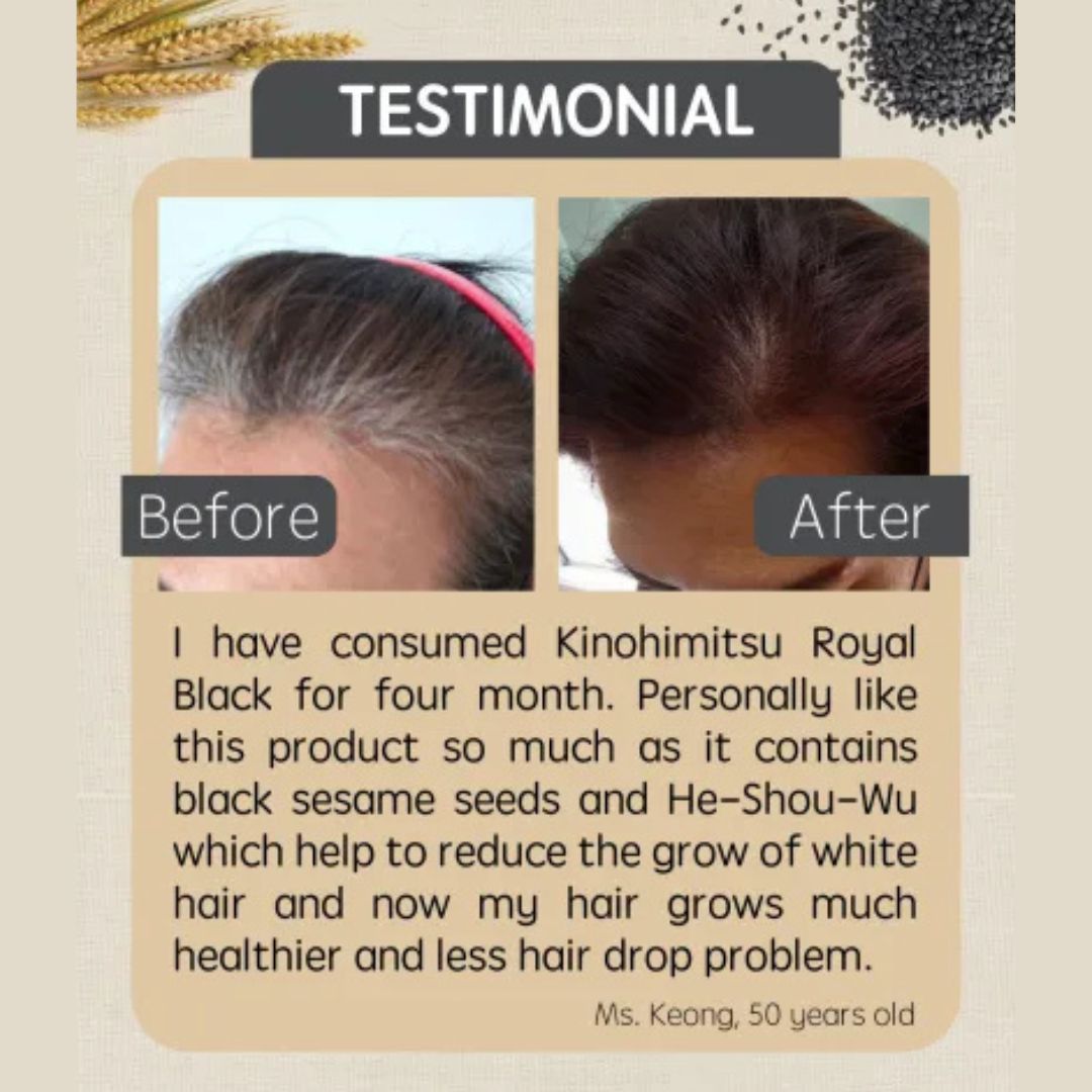 Testimonial from Ms. Keong, 50, showing before-and-after photos. After 4 months of Kinohimitsu Royal Black, her hair looks healthier with reduced hair drop. She appreciates black sesame and He-Shou-Wu for reducing white hair growth.